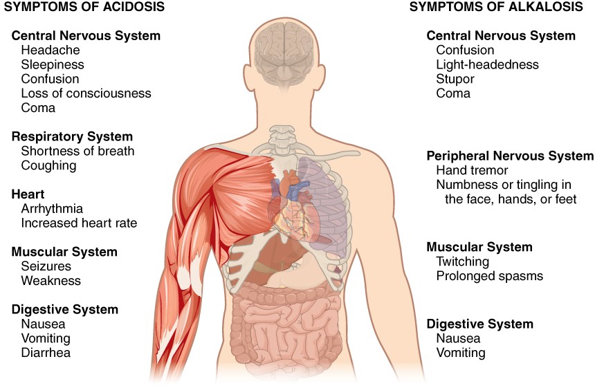 Disorders of Acid-Base Balance | Anatomy and Physiology II