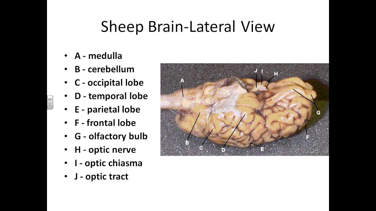 Online A& P I Lab Sheep Brain Dissection
