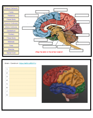 Brain Label (Remote)