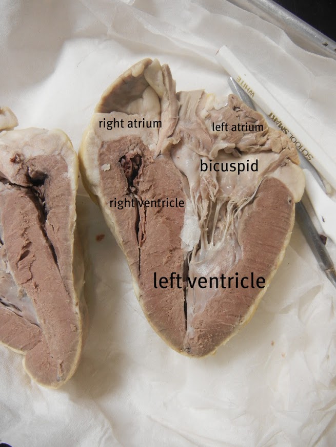 Heart Dissection Walk Through