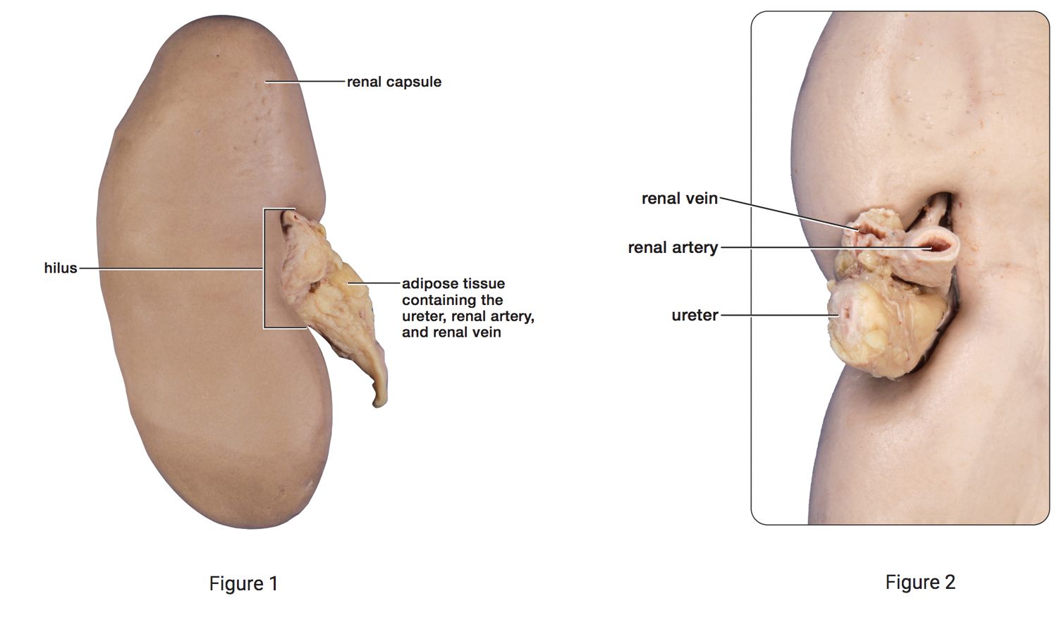 Mammalian Kidney Dissection | Carolina Biological Supply