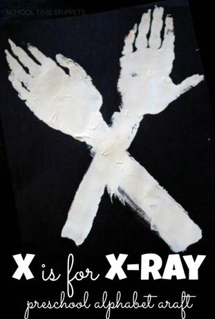 letter x activities for toddlers