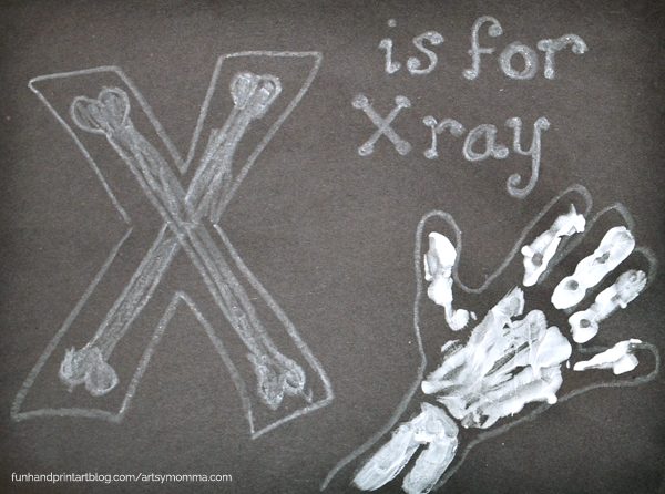 Handprint X-ray - Letter X Craft - Fun Handprint Art