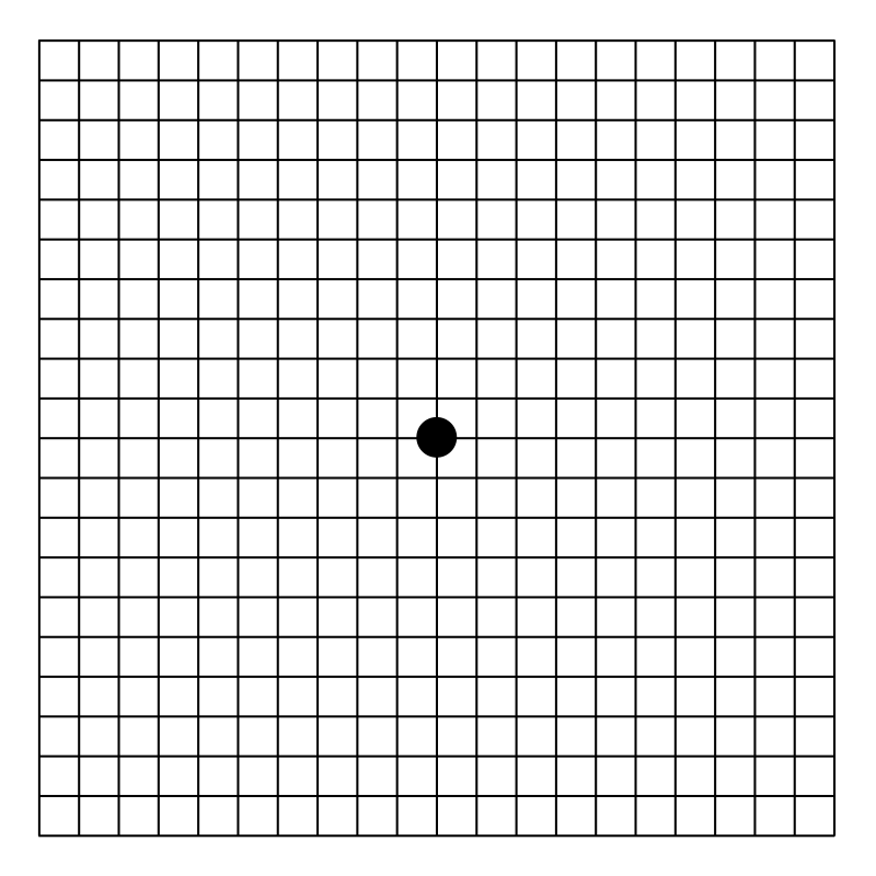 Amsler grid - Wikipedia