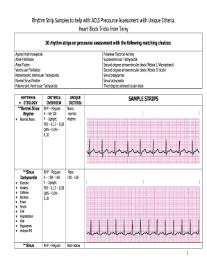 printable heart rhythm strips