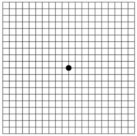 Amsler Grid Eye Test - Free Printable PDF | BrightFocus Foundation
