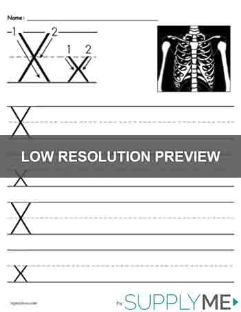 15+ Letter X Worksheets: Free &  Easy Print - The Simple Homeschooler