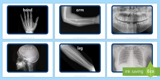 printable pictures of x rays