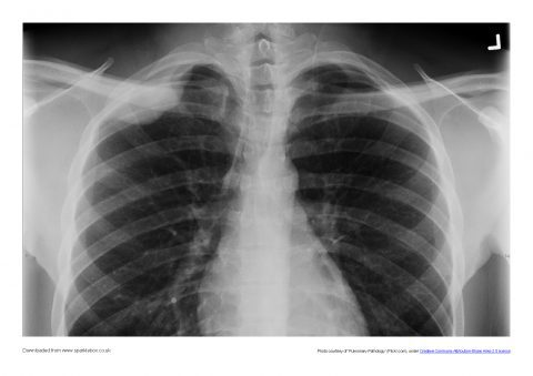 printable pictures of x rays
