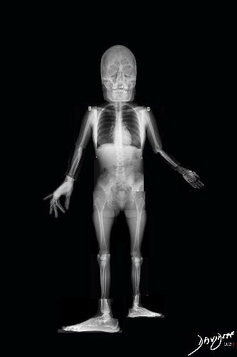 printable pictures of x rays