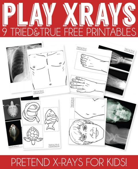 printable pictures of x rays