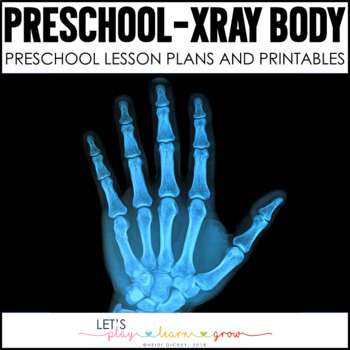 printable x rays