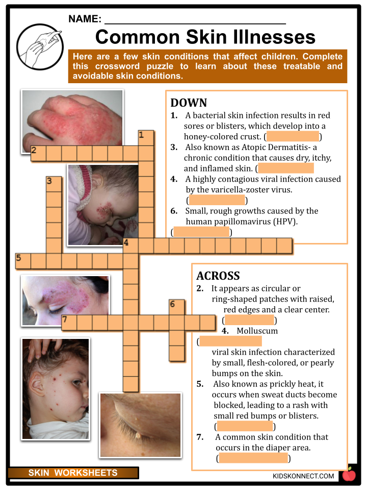 Skin Worksheets | Skin Structure, Function, Health